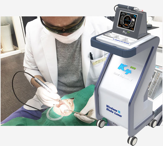 치과용 레이저 장비 K4 ECO LASER 시술 모습