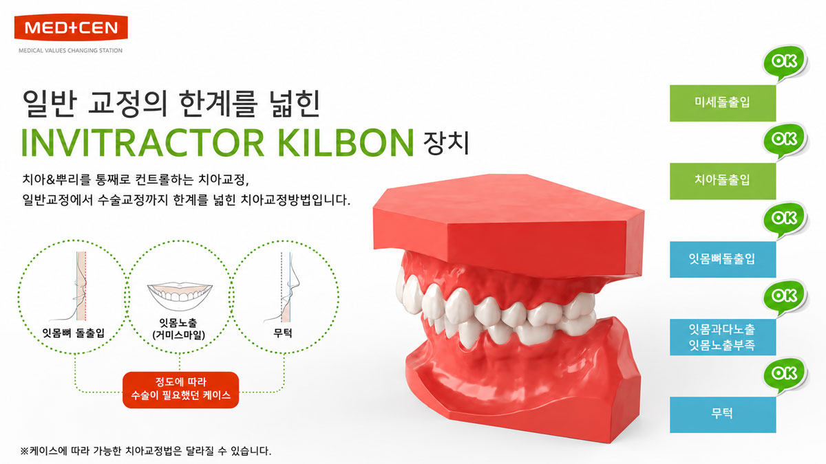 INVITRACTOR KILBON 장치를 적용한 치아교정 과정 설명